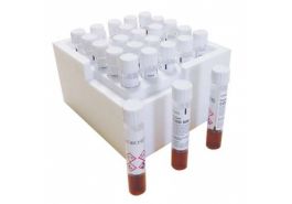 Test tube COD LR 0 - 150 mg/l - 25 tubes